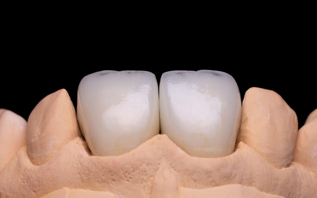 ©Manfred Pressinger Dentalsolutions